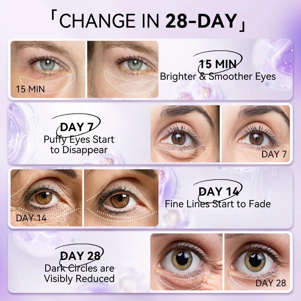 LANBENA Retinol Masker Mata An - Microneedle Patch Eye ulasan dan harga