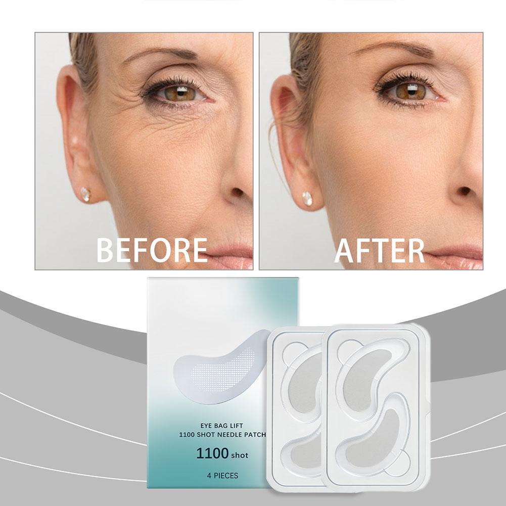 Masker Penutup Mata Microneedl - Microneedle Patch Eye ulasan dan harga